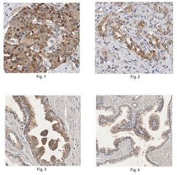 Anti-Olfactomedin-4/OLFM4 Antibody from rabbit, purified by affinity chromatography