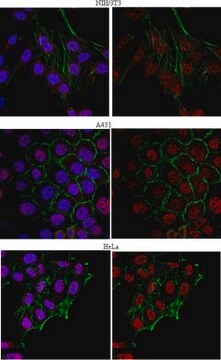 Anti-SRp30b (SC35) Antibody from rabbit