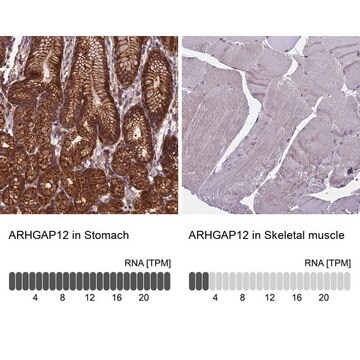 Anti-ARHGAP12 antibody produced in rabbit Prestige Antibodies&#174; Powered by Atlas Antibodies, affinity isolated antibody, buffered aqueous glycerol solution