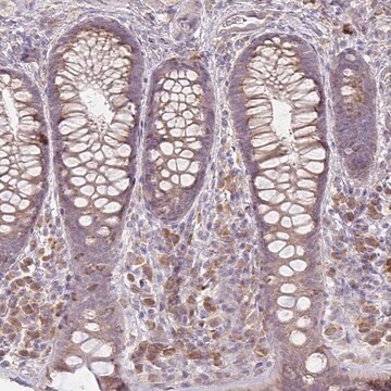 Anti-BRINP3 antibody produced in rabbit Prestige Antibodies&#174; Powered by Atlas Antibodies, affinity isolated antibody, buffered aqueous glycerol solution