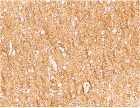 Anti-ATR antibody produced in rabbit purified antibody (Ion exchange)