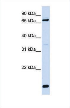 抗ACSL4抗体 ウサギ宿主抗体 affinity isolated antibody