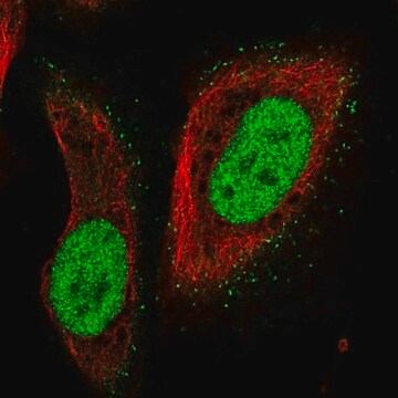 Anti-PMS2 antibody produced in rabbit Prestige Antibodies&#174; Powered by Atlas Antibodies, affinity isolated antibody