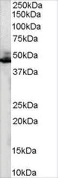 Anti-ADRB2R/ADRB2 antibody produced in goat affinity isolated antibody, buffered aqueous solution