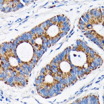 Anti- Bax antibody produced in rabbit