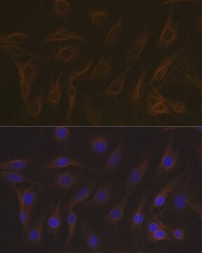 Anti-EB3/MAPRE3 antibody produced in rabbit