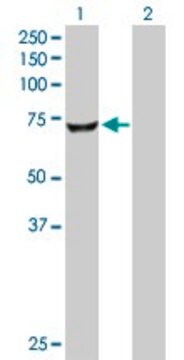 Anti-CROT antibody produced in rabbit purified immunoglobulin, buffered aqueous solution