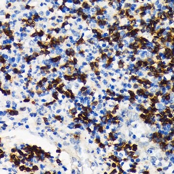 Anti-CD7 antibody produced in rabbit