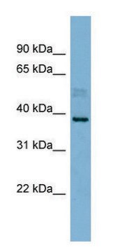 Anti-MARCH8 (N-terminal) antibody produced in rabbit affinity isolated antibody