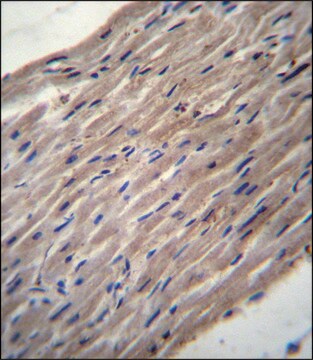 ANTI-PLOD1 (N-TERM) antibody produced in rabbit IgG fraction of antiserum, buffered aqueous solution