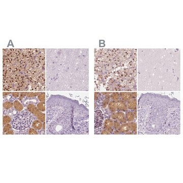 Anti-GALM antibody produced in rabbit Prestige Antibodies&#174; Powered by Atlas Antibodies, affinity isolated antibody, buffered aqueous glycerol solution