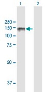 ANTI-LPIN2 antibody produced in mouse purified immunoglobulin, buffered aqueous solution