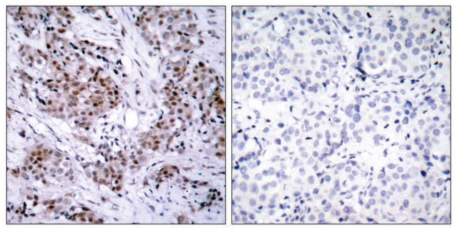 Anti-Estrogen Receptor-&#945; antibody produced in rabbit affinity isolated antibody