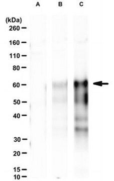 Anti-phospho-ACD (Ser255) Antibody, clone 34B10