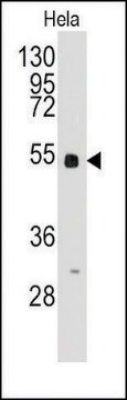 Anti-BBS4 (center) antibody produced in rabbit saturated ammonium sulfate (SAS) precipitated, buffered aqueous solution