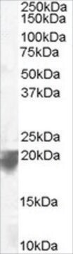 Anti-VPS29, C-Terminal antibody produced in goat affinity isolated antibody, buffered aqueous solution