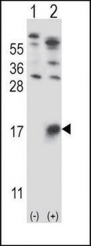 ANTI-GYPB (CENTER) antibody produced in rabbit IgG fraction of antiserum, buffered aqueous solution