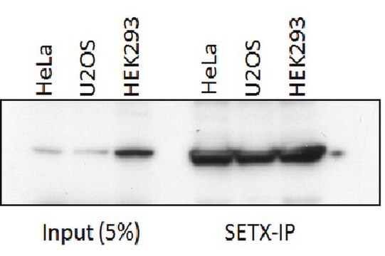 Anti-Senataxin (OY11) Antibody from rabbit, purified by affinity chromatography