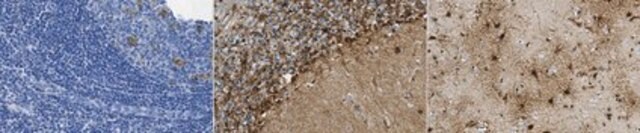 Anti-Glutamine Synthetase Antibody, clone 11A3.1 clone 11A3.1, from mouse