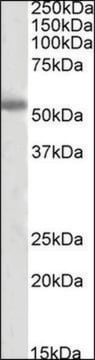 Anti-TH (C-terminal) antibody produced in goat affinity isolated antibody, buffered aqueous solution