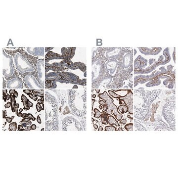 抗TGM2抗体 ウサギ宿主抗体 Prestige Antibodies&#174; Powered by Atlas Antibodies, affinity isolated antibody, buffered aqueous glycerol solution