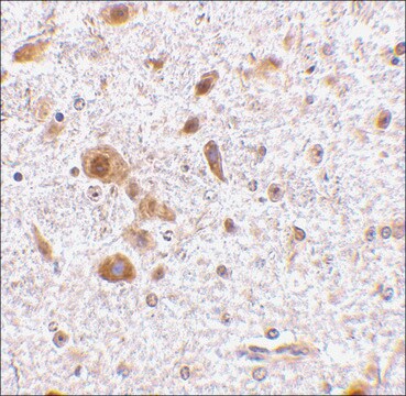 Anti-TSLP (ab3) antibody produced in rabbit affinity isolated antibody