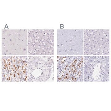 Anti-KCNE2 antibody produced in rabbit Prestige Antibodies&#174; Powered by Atlas Antibodies, affinity isolated antibody, buffered aqueous glycerol solution