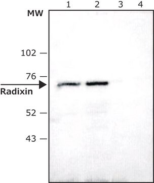 Anti-Radixin antibody produced in rabbit affinity isolated antibody, buffered aqueous solution