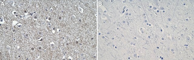 Anti-P2X7 Antibody, clone 1D23-1 ZooMAb&#174; Rabbit Monoclonal recombinant, expressed in HEK 293 cells