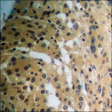 Anti-phospho-TK (pSer13) antibody produced in rabbit affinity isolated antibody