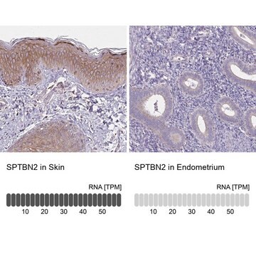 Anti-SPTBN2 antibody produced in rabbit Prestige Antibodies&#174; Powered by Atlas Antibodies, affinity isolated antibody, buffered aqueous glycerol solution