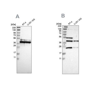 Anti-CCDC51 antibody produced in rabbit Prestige Antibodies&#174; Powered by Atlas Antibodies, affinity isolated antibody, buffered aqueous glycerol solution