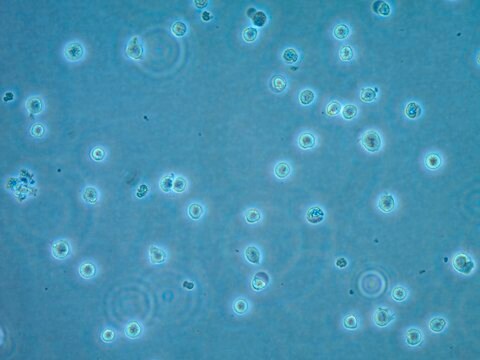 CUTLL1 Human T-cell Lymphoblastic Lymphoma Cell Line