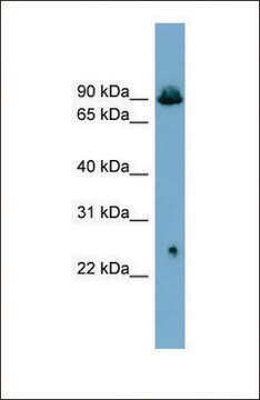 Anti-SLC6A5 antibody produced in rabbit affinity isolated antibody