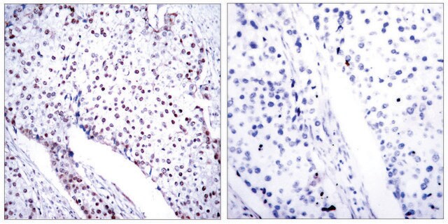 Anti-STAT3 (Ab-705) antibody produced in rabbit affinity isolated antibody