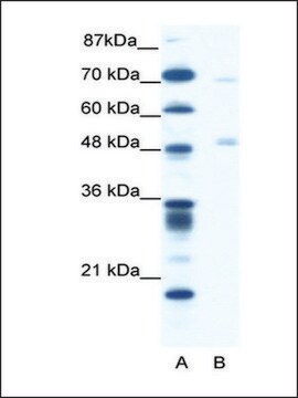 Anti-PNLIP (AB1) antibody produced in rabbit IgG fraction of antiserum