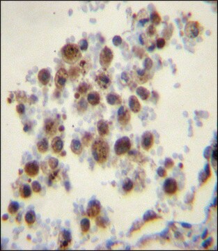 ANTI-CYP5A1 (CENTER) antibody produced in rabbit IgG fraction of antiserum, buffered aqueous solution