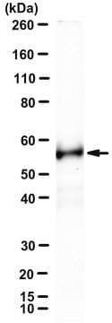 Anti-RIPK3/RIP3 Antibody, clone 1H2