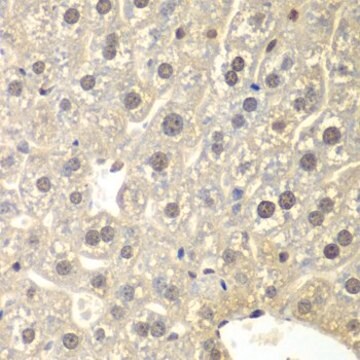 Anti-NR3C1 antibody produced in rabbit