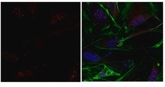 Anti-ESRRB Antibody from rabbit, purified by affinity chromatography