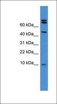 Anti-BMP2 antibody produced in rabbit affinity isolated antibody