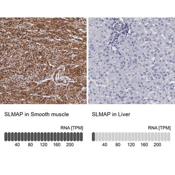 Anti-SLMAP antibody produced in rabbit Ab1, Prestige Antibodies&#174; Powered by Atlas Antibodies, affinity isolated antibody, buffered aqueous glycerol solution