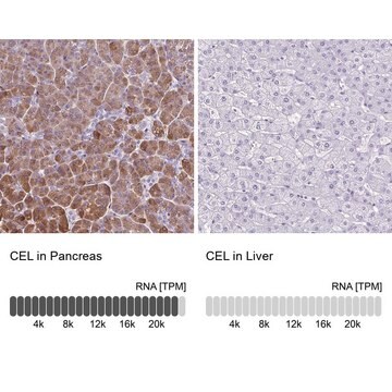 Anti-CEL antibody produced in rabbit Prestige Antibodies&#174; Powered by Atlas Antibodies, affinity isolated antibody, buffered aqueous glycerol solution