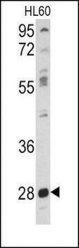 Anti-PKMYT1 (center) antibody produced in rabbit IgG fraction of antiserum, buffered aqueous solution