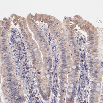 Anti-RNASEL antibody produced in rabbit Prestige Antibodies&#174; Powered by Atlas Antibodies, affinity isolated antibody, buffered aqueous glycerol solution