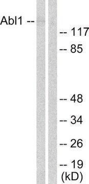 Anti-ABL antibody produced in rabbit affinity isolated antibody