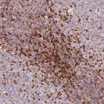 抗GBP2抗体 ウサギ宿主抗体 Prestige Antibodies&#174; Powered by Atlas Antibodies, affinity isolated antibody, buffered aqueous glycerol solution