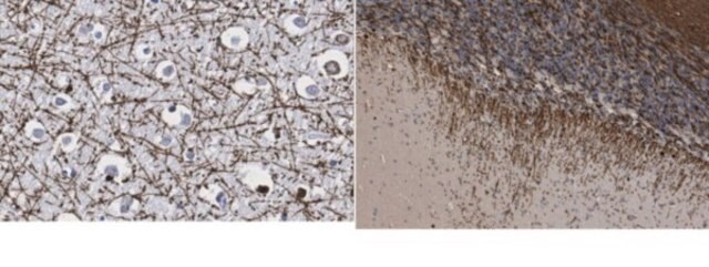 Anti-Myelin Basic Protein from rabbit, purified by affinity chromatography