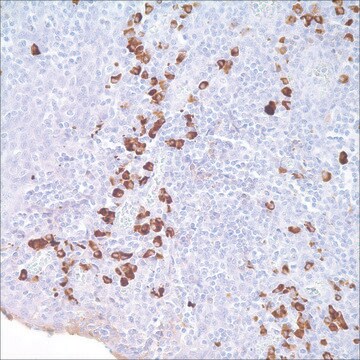 IgA Rabbit Polyclonal Antibody