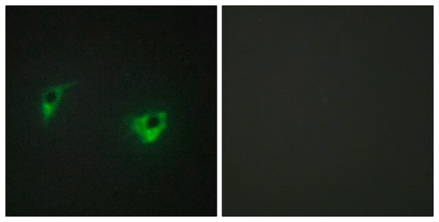 Anti-MEKKK 4 antibody produced in rabbit affinity isolated antibody